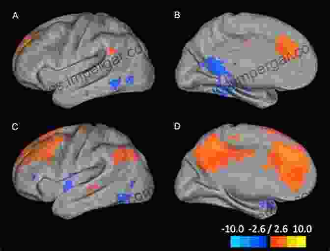 FMRI Image Showing Brain Connectivity Patterns In Depression Functional MRI: Applications In Clinical Neurology And Psychiatry