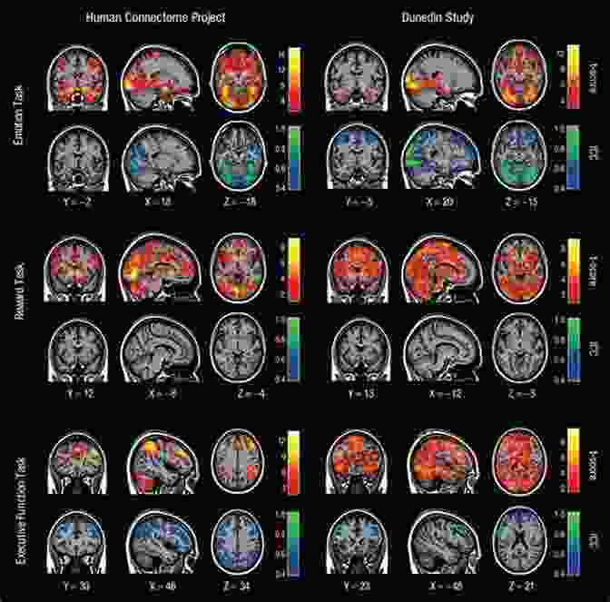 FMRI Image Showing The Effects Of Psychotherapy On Brain Activity Functional MRI: Applications In Clinical Neurology And Psychiatry