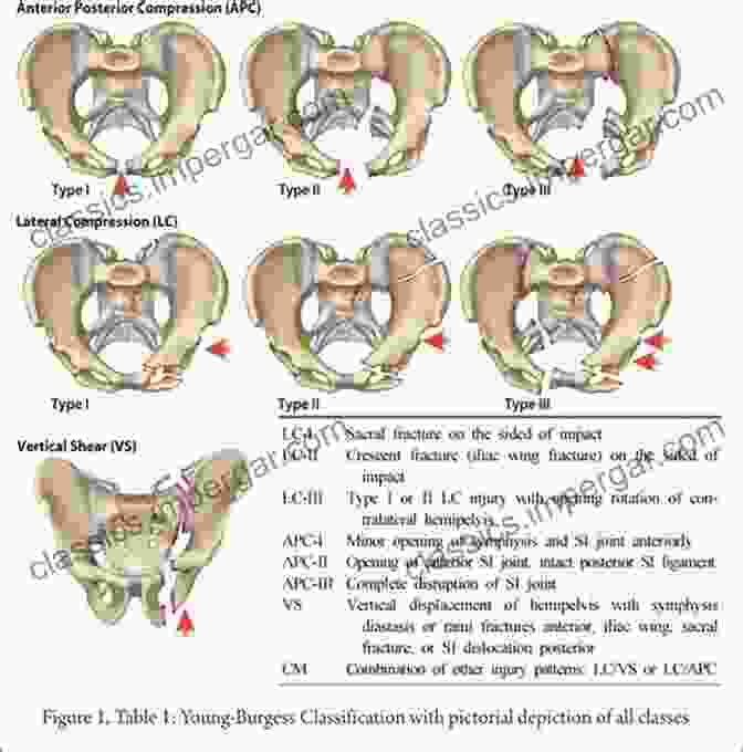 Pelvis And Acetabular Injury Management Emergency Room Orthopaedic Procedures: An Illustrative Guide For The House Officer