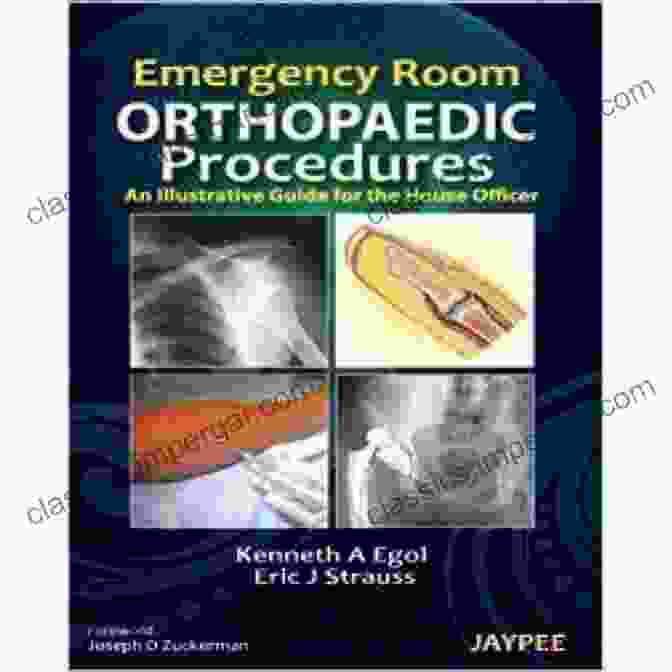 Spine Injury Management Emergency Room Orthopaedic Procedures: An Illustrative Guide For The House Officer