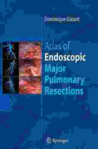 Atlas Of Endoscopic Major Pulmonary Resections