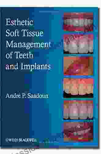 Esthetic Soft Tissue Management Of Teeth And Implants