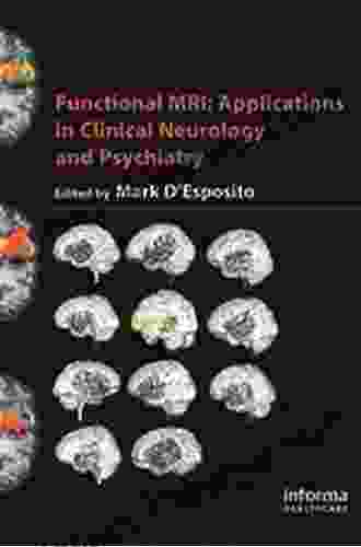 Functional MRI: Applications In Clinical Neurology And Psychiatry